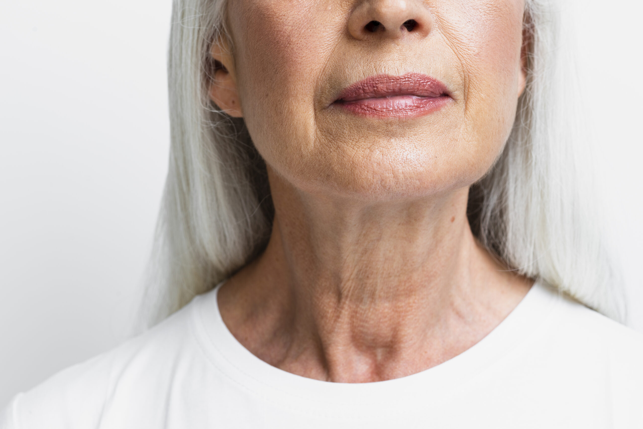 Cervicoplastia